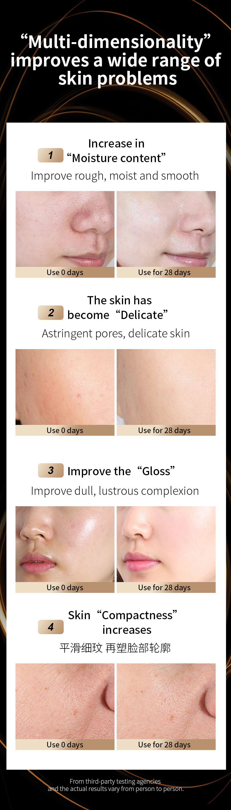 shanilak cross-border bestseller beauty Device: Home facial lifting and firming Introduction Device, facial care device, suitable for beauty salons pic 4