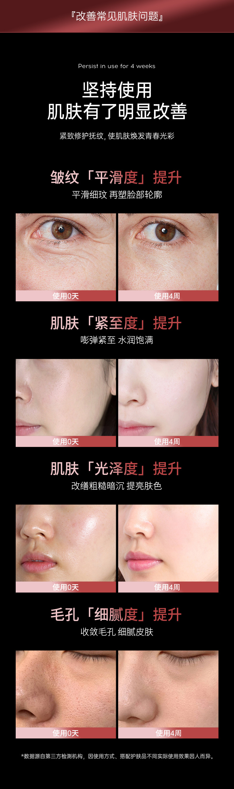 美容仪EMS微电流眼部按摩美眼仪加热眼霜精华导入仪淡化细纹面部详情10