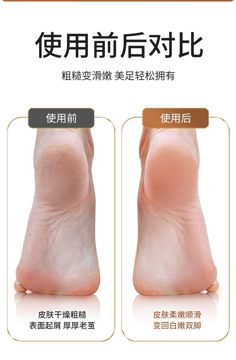 shanilak   跨境家用新款磨脚器电动修脚器脚底脚后跟修脚死皮打磨用工具详情6