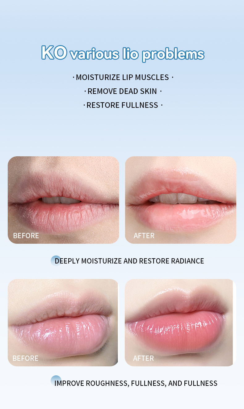 【 Cross-border Exclusive 】ADMD Lip Mask 4-piece Set Box Moisturizing, Hydrating and Exfoliating Fruit-flavored Lip Mask wholesale pic 13