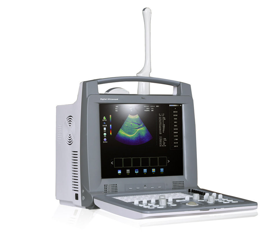 Foreign trade exclusive supply medical Color Doppler ultrasound machine Trolley Color Doppler cart vertical color B-ultrasound Doppler pic 18