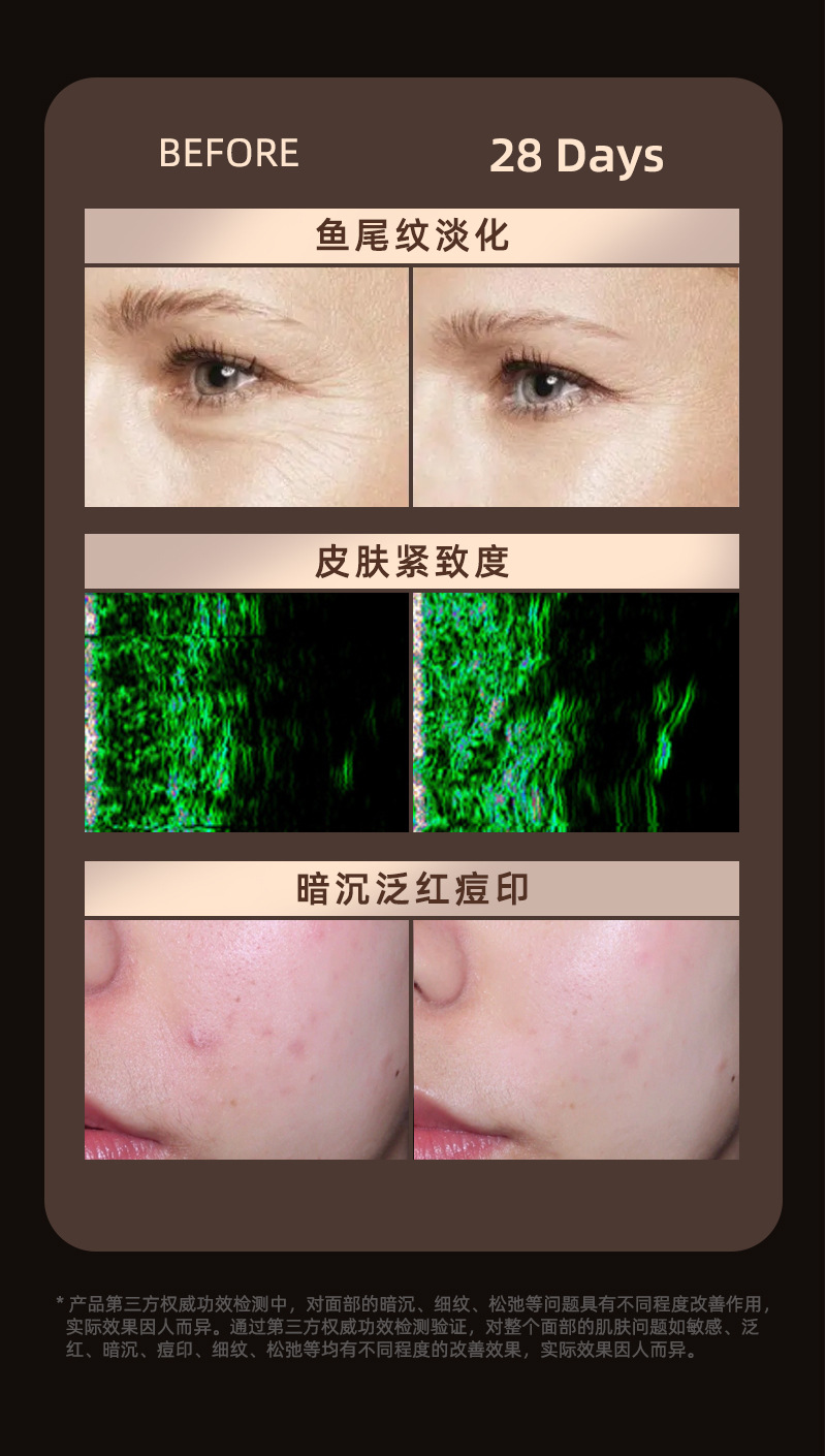 shanilak 美容面罩光子嫩肤仪光谱仪家用美容仪82颗硅胶led面罩 pic 2