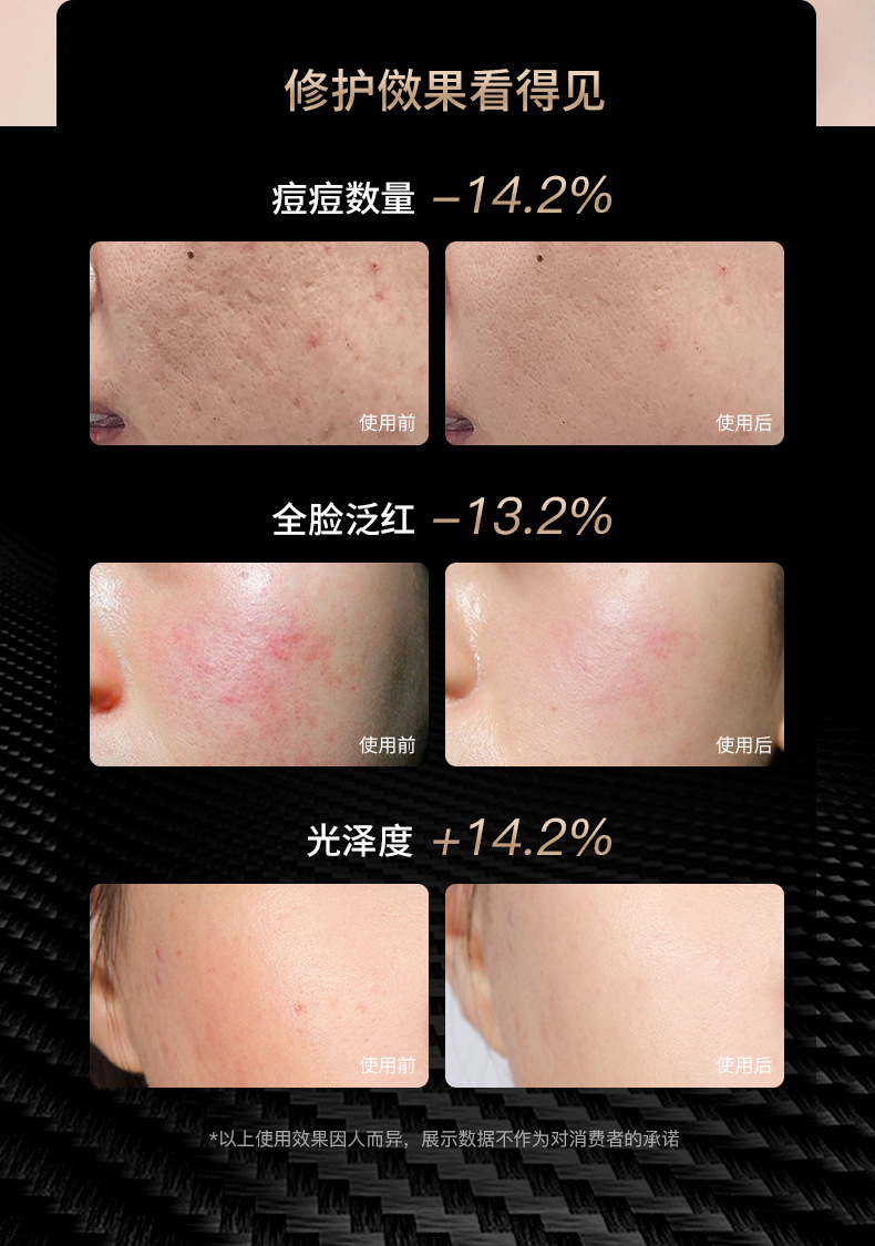 shanilak Home Red LEDLCD color light beauty brightening and Stabilizing Face Mask Device pic 4