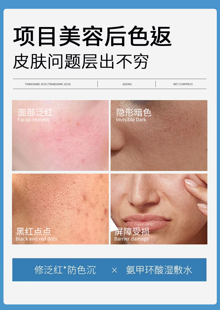 5%氨甲环酸烟酰胺湿敷液精华液外用传明酸改善暗沉提亮肤色正品详情7