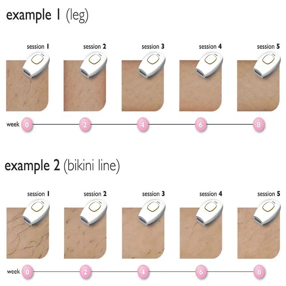 Cross-border small package low-price high-volume home laser hair removal device, painless ipl laser hair removal device for the whole body pic 7