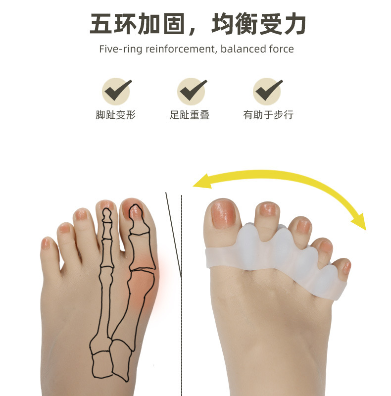 Cross-border bestseller: Five-hole toe separation correction set for hallux valgus, a unisex toe orthopedic wonder, a toe separator pic 6