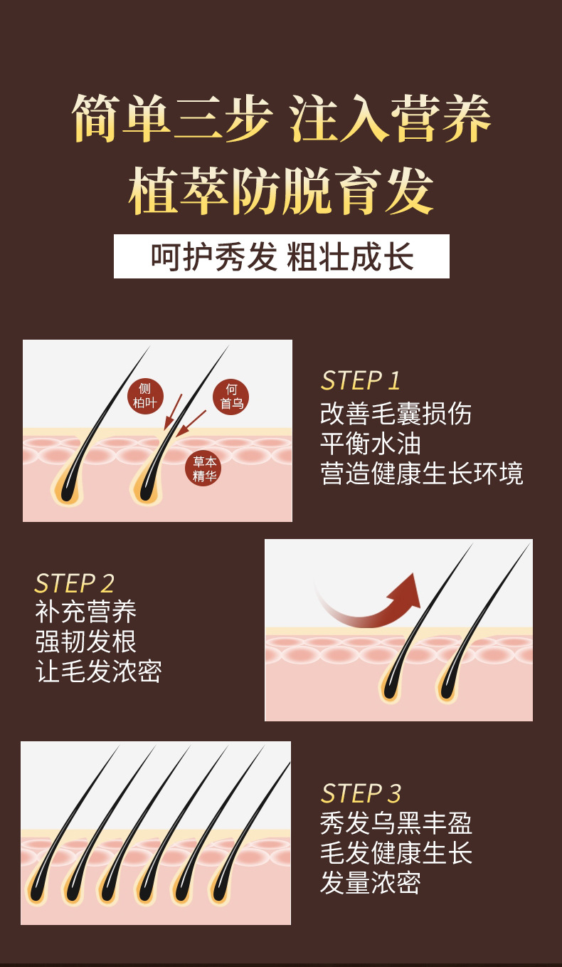 北同医药育发液头发际线营养剂发增密快速增长男女防脱草本精华液详情5
