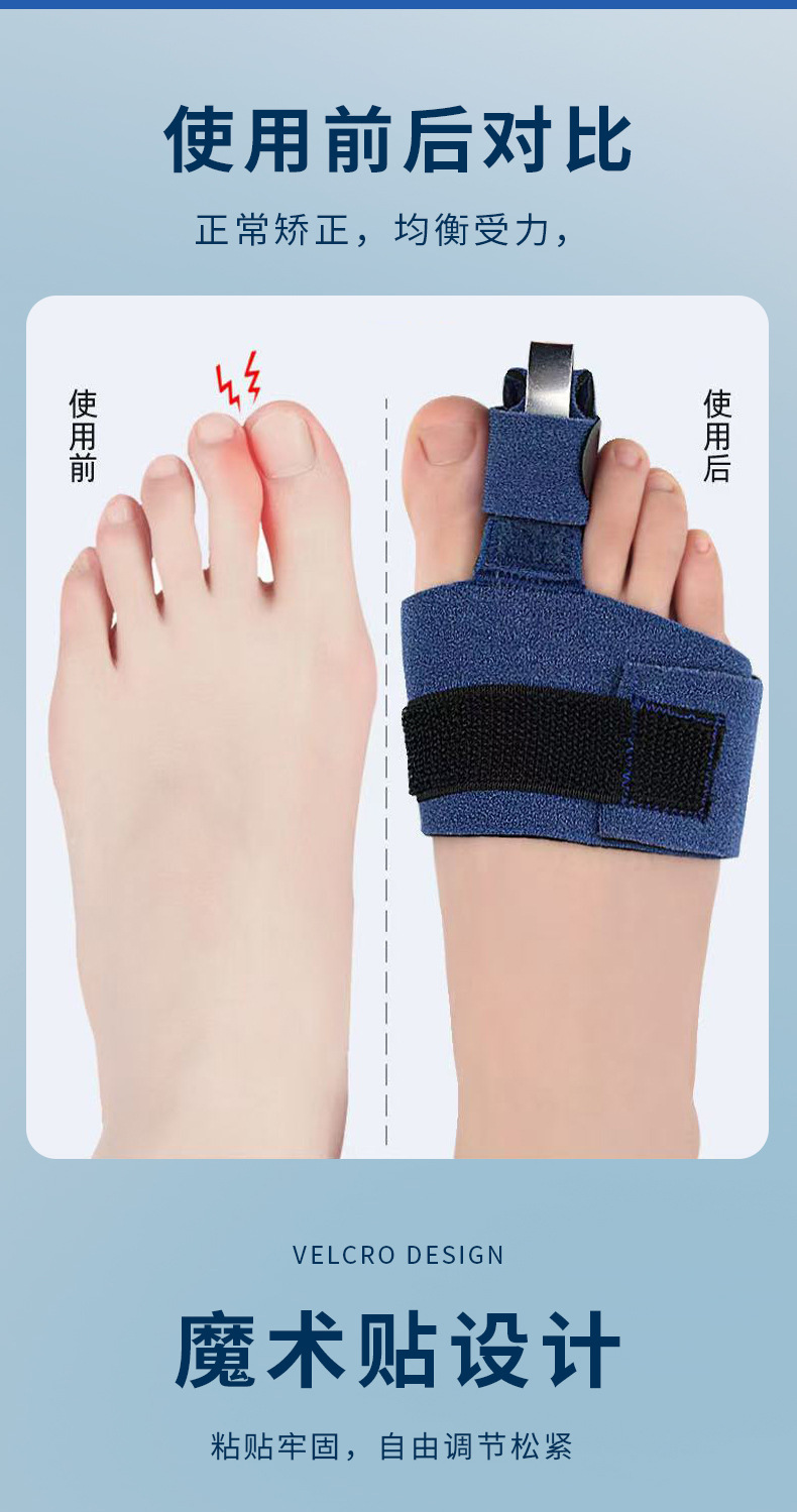 Blue orthodontic toe correction band, suitable for both men and women, relieves foot discomfort. Genuine product, fracture rehabilitation, and toe fixation pic 3