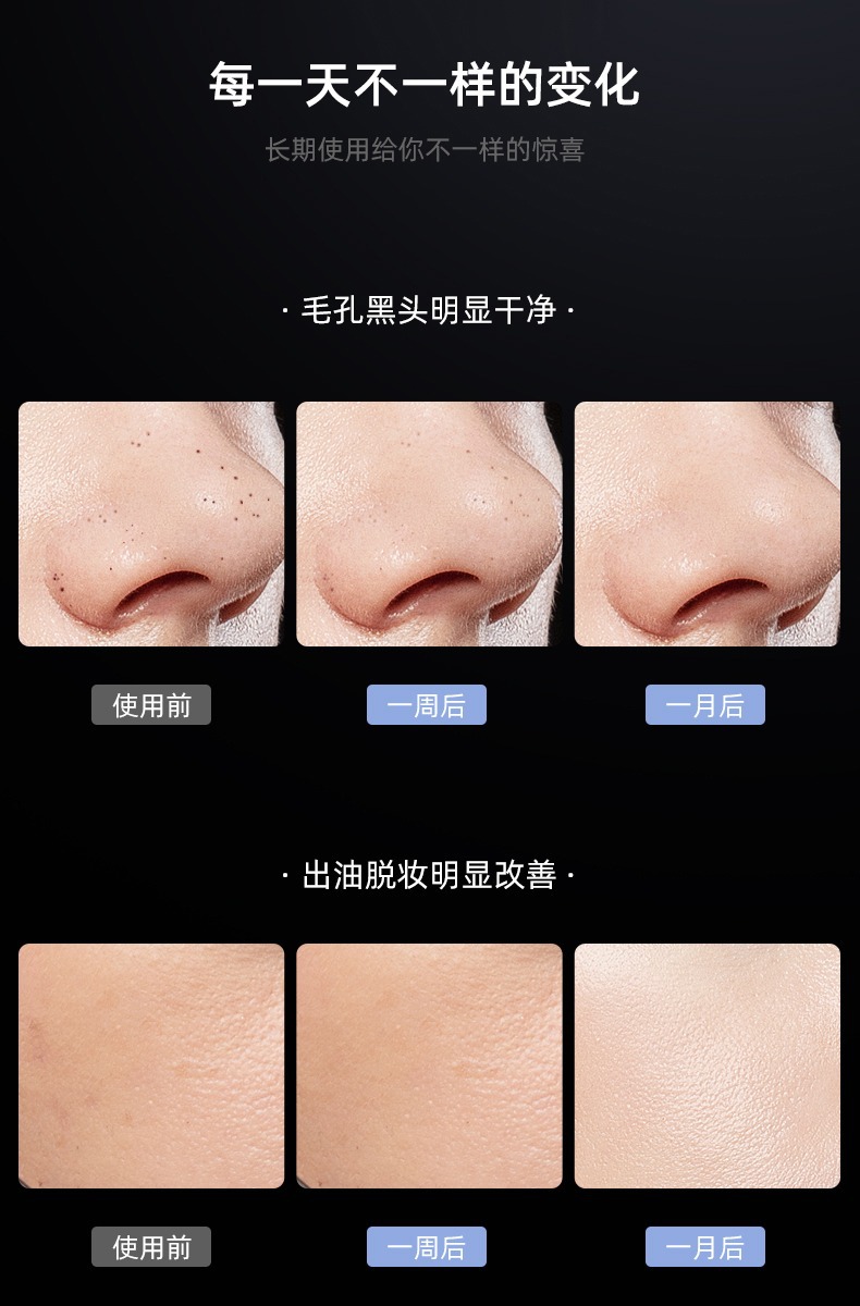 去黑头铲皮机脸面部毛孔清洁铲皮刀家用洁面导入出超声波美容仪器详情9