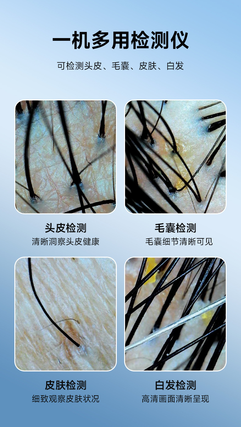 shanilak   家用头皮头囊检测仪数码高清100W像素电子显微镜可拍照皮肤检测仪详情4