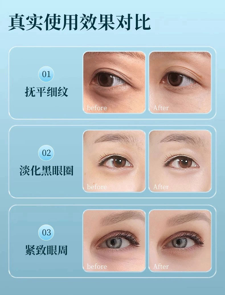EMS Microcurrent Cold and Hot Compress Color Light Eye Beauty Device, Eye Massage Device, Eye Cream Infusion Device, Lifting, firming and Beauty Device pic 9
