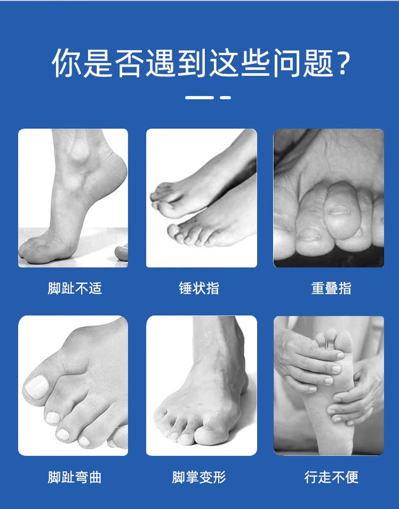 Blue orthodontic toe correction band, suitable for both men and women, relieves foot discomfort. Genuine product, fracture rehabilitation, and toe fixation pic 2
