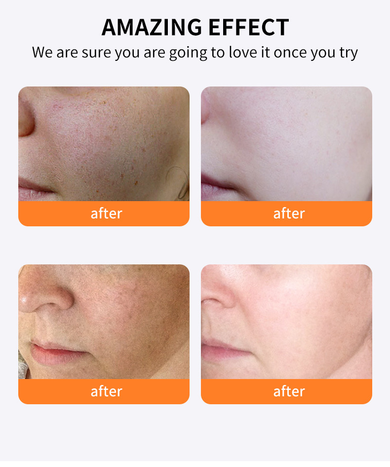 跨境VC精华霜收缩毛孔提亮抗皱紧致面霜50g外贸whitening cream详情11