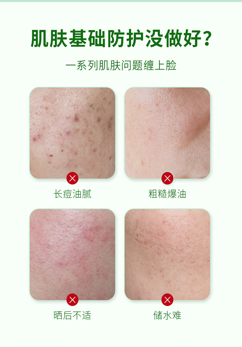 热卖OPOSi库拉索芦荟凝胶500g大容量面部护理淡化痘保湿补水润肤详情3