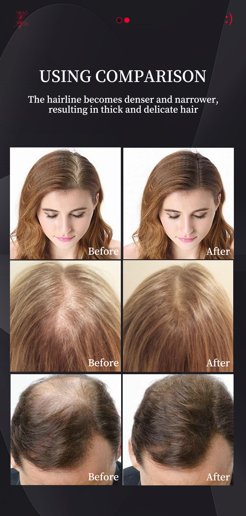 【跨境专供】FORMBO男女洗发水二合一深沉清洁浓密护发洗发水批发详情15