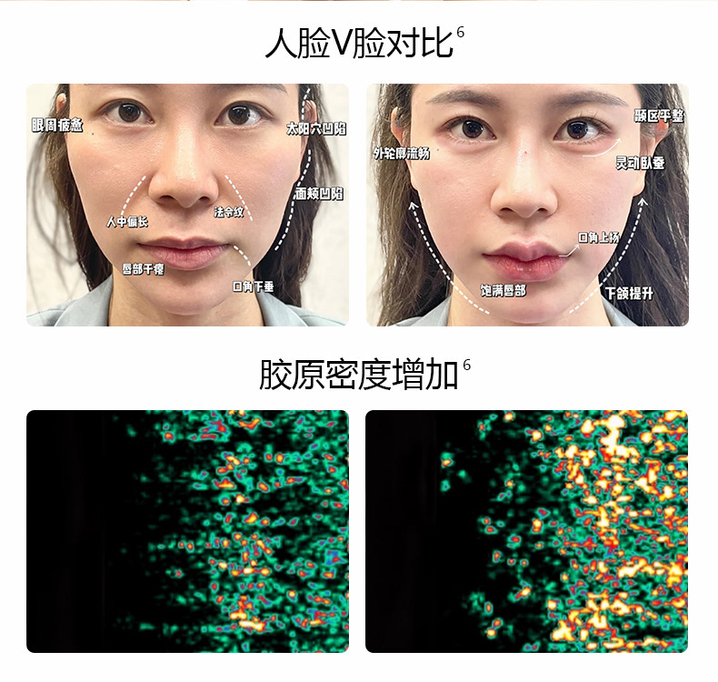 2025 New EMS multi-functional Facial lifting, firming and Massage Device for Hair Care and Nourishment pic 5