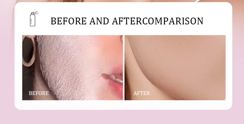 跨境专供FORMBO毛发识别喷雾配脱毛刀净肤清洁温和脱毛喷雾批发详情6