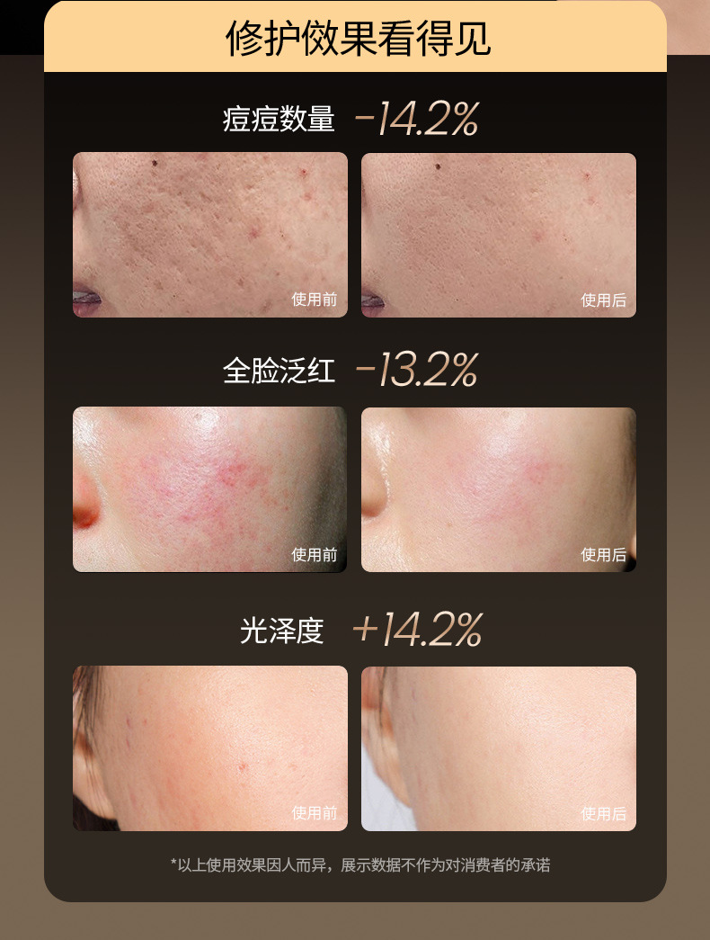 硅胶彩光面罩光子嫩肤仪美容仪脸部红蓝光美容面膜仪家用大排灯详情8