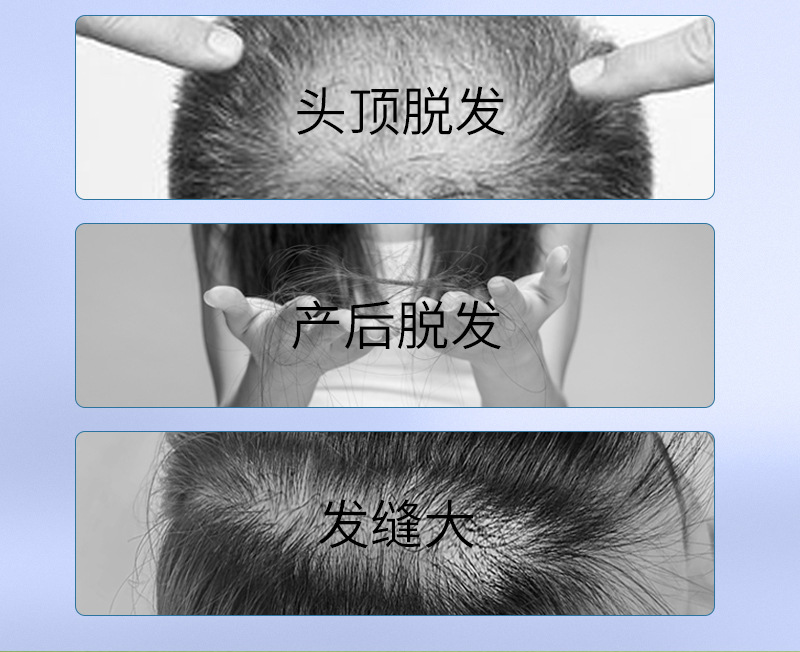 发功夫生姜洗发水防脱发固发育发正控油蓬松去屑洗头膏露男女详情3
