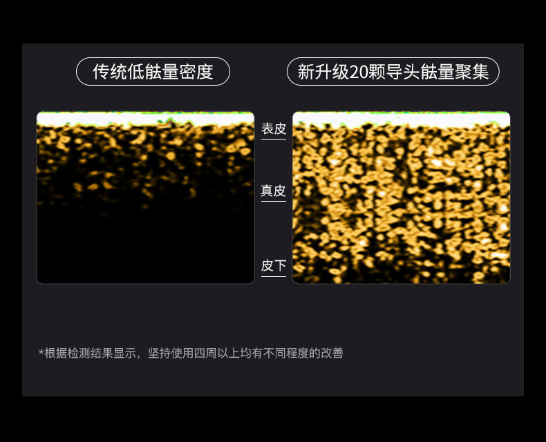 shanilak   跨境美容仪家用面部大熨斗胶原炮脸部按摩导入美容仪黄金胶原炮详情7