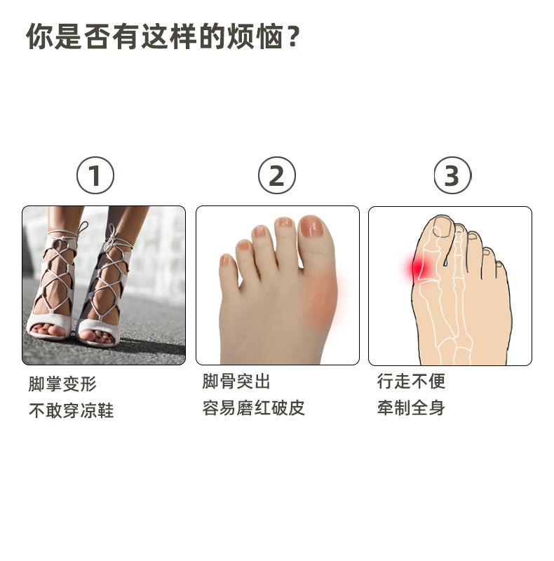 Cross-border bestseller: Five-hole toe separation correction set for hallux valgus, a unisex toe orthopedic wonder, a toe separator pic 4