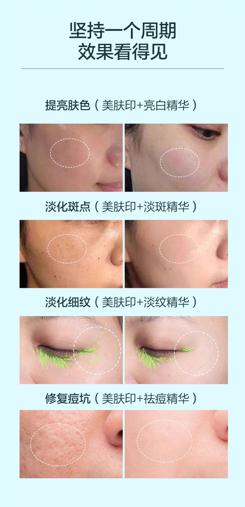 shanilak   微晶导入仪按压式手动导入纳米微针导入浅导冻干粉家用微晶美肤印详情7