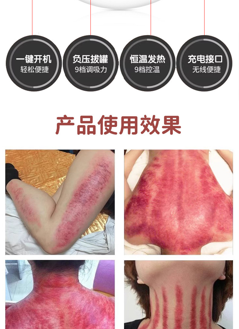 shanilak   吸痧经络按摩仪全身按摩筋膜刮痧拔罐美容院仪器家用详情10