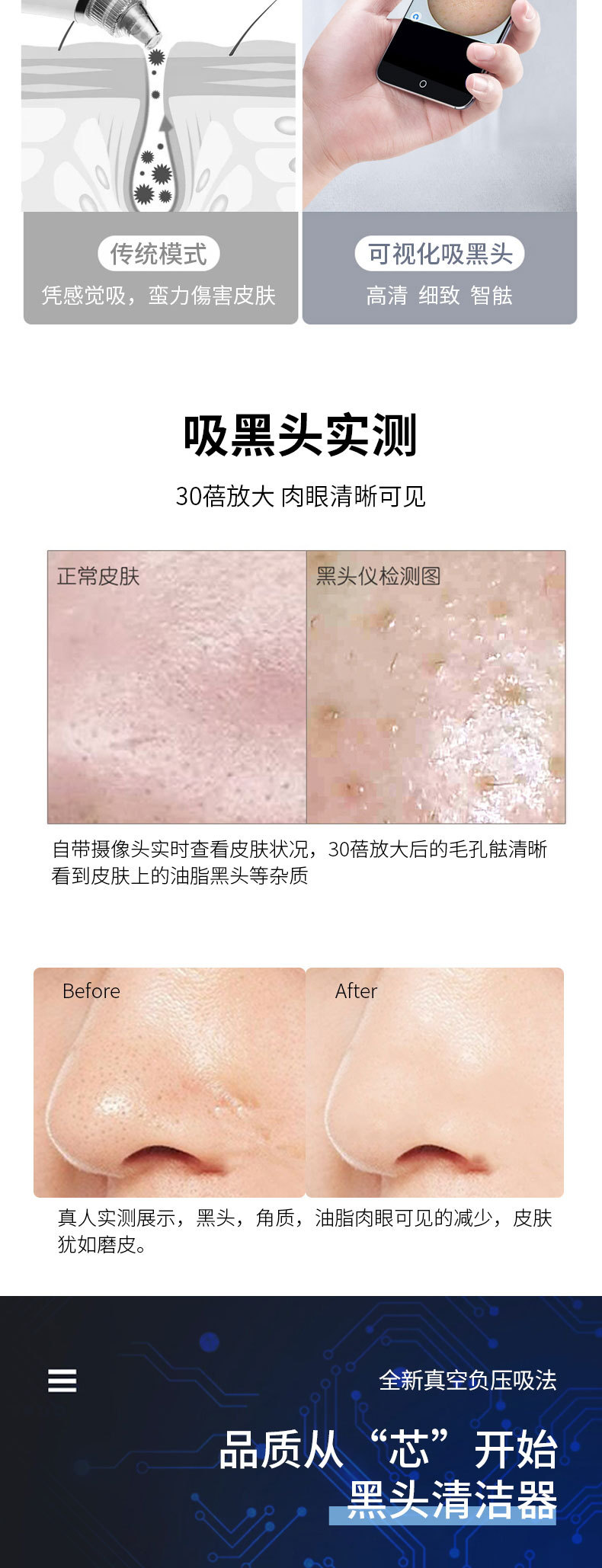 黑头仪可视化新款电动吸黑头仪器美容仪去黑头毛孔清洁仪器跨境详情7