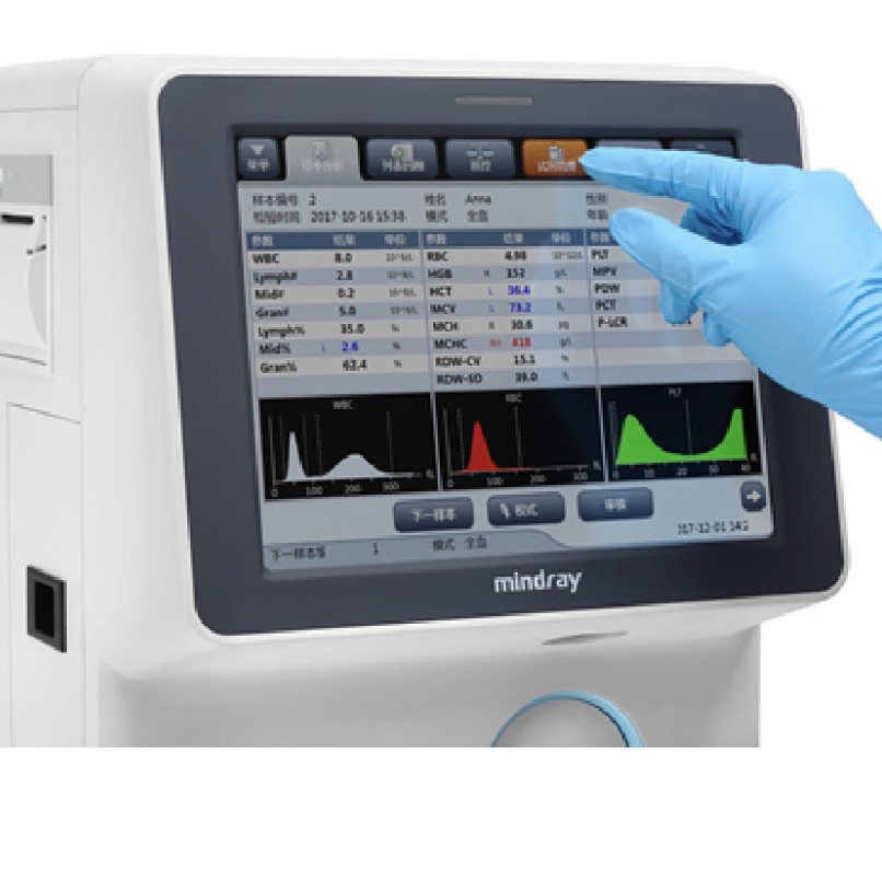 Mindray fully automatic blood analyzer BC-20 medical three-category blood analyzer testing machine CBC pic 7