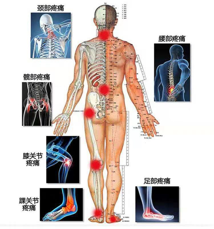 批发足弓矫正鞋垫XO型腿足内翻半垫TPR足跟塌陷支撑扁平足后跟垫详情7