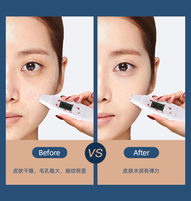 shanilak Water Replenishment device, portable handheld high-pressure oxygen injection device, nano introduction device, beauty sprayer, beauty equipment pic 9