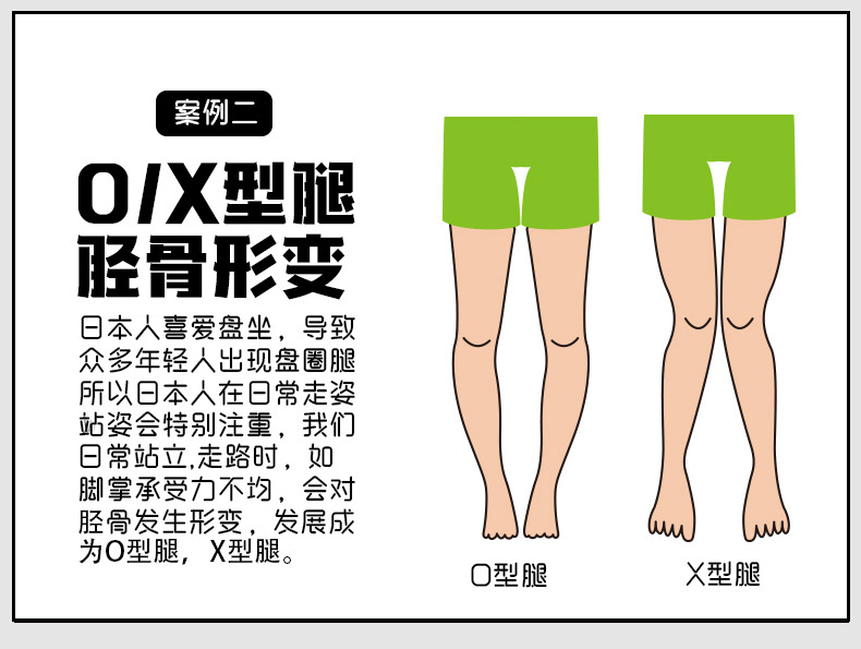 扁平足鞋垫足弓矫正足外翻内八字平底xo型腿足底矫正平足后跟垫详情6