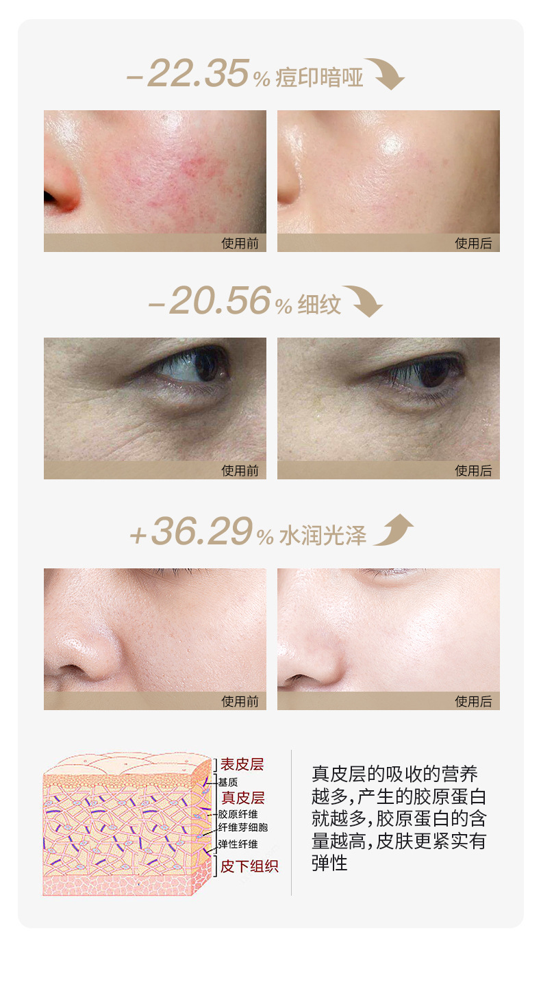 shanilak  家用美容补水仪器纳米电动水光枪详情14