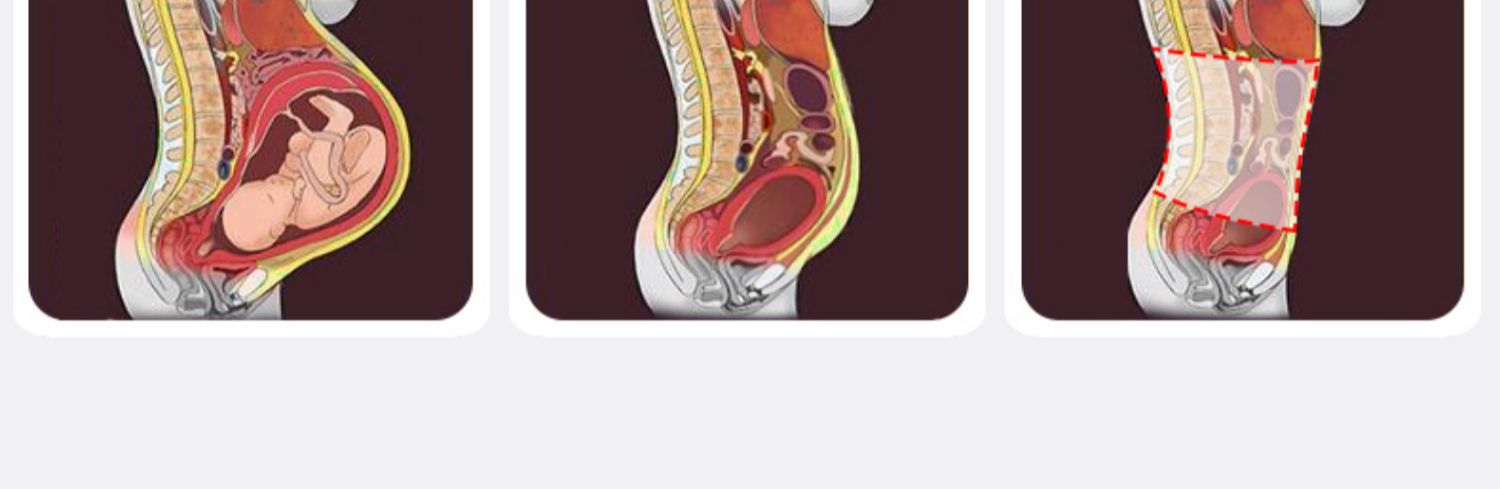 4贴产后收腹带产妇顺剖两用塑腰月子束腰束腹束缚带透气套女详情11