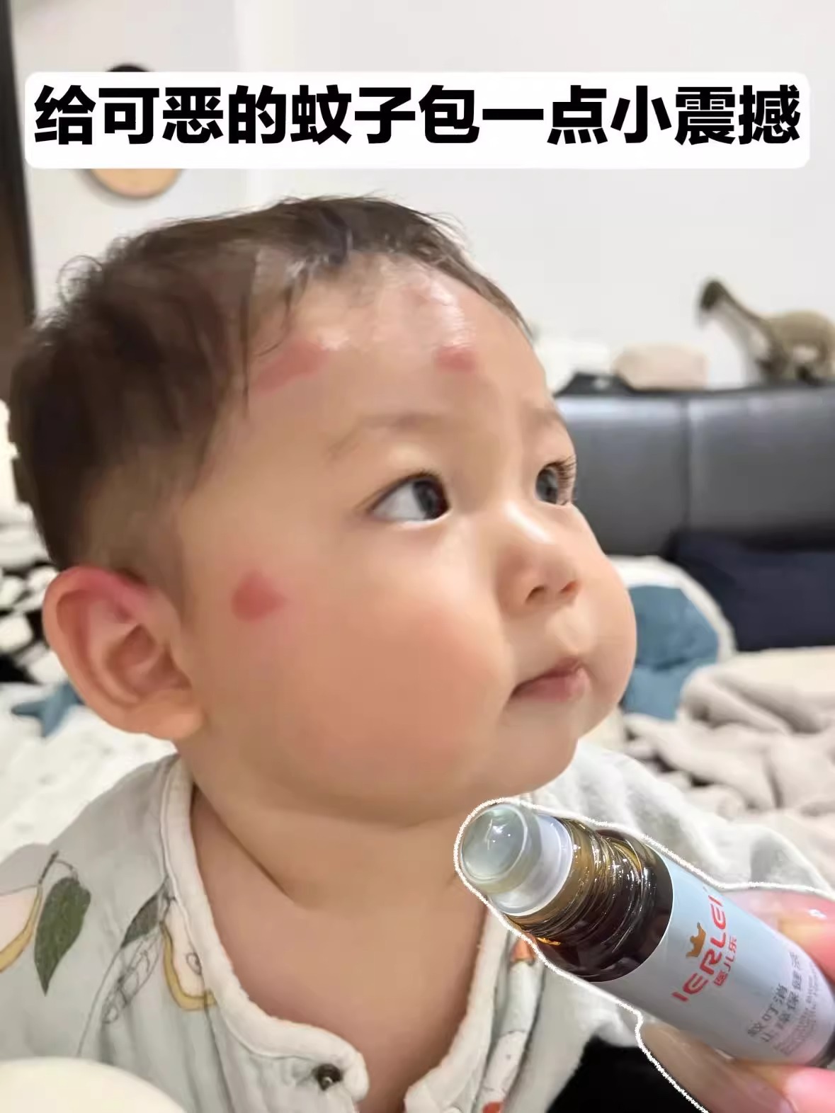 IERLEI医儿乐蚊叮消全新升级蚊叮消乳膏蚊虫叮咬驱蚊液小孩通用详情6