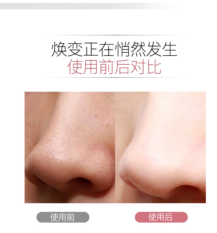 皮肤清洁仪洁面毛孔去死皮铲皮机震动清洁电动家用洗脸美容仪详情7