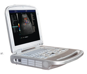 Foreign trade exclusive supply medical Color Doppler ultrasound machine Trolley Color Doppler cart vertical color B-ultrasound Doppler pic 14