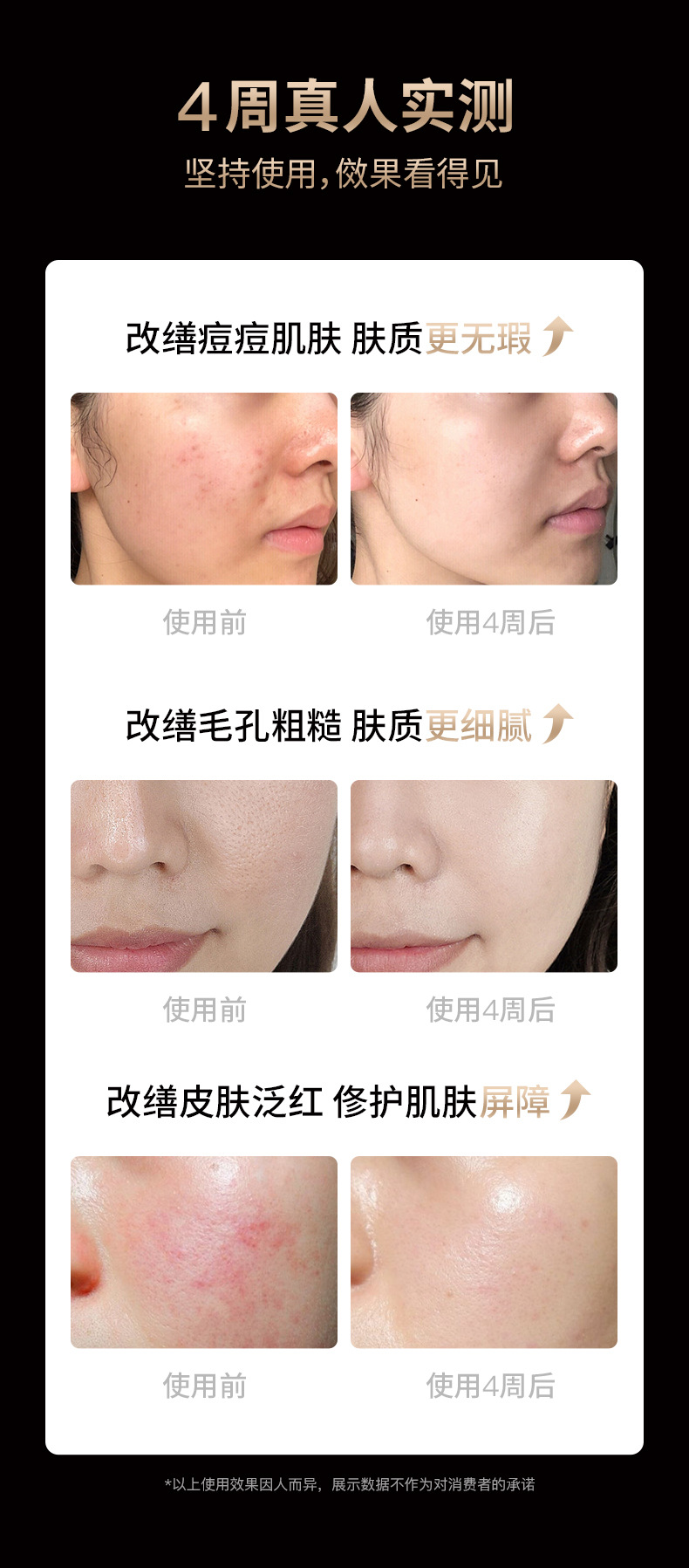shanilak Home Red LEDLCD color light beauty brightening and Stabilizing Face Mask Device pic 14