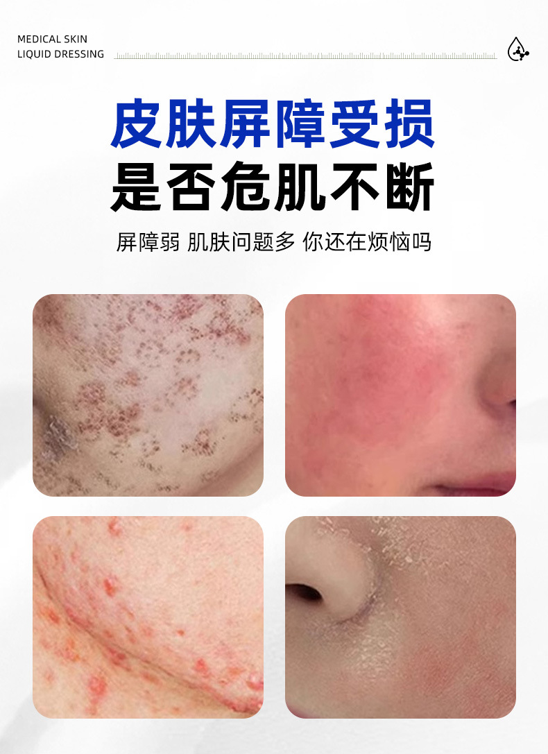 Sodium hyaluronate laser photon fruit acid exchange micro-plastic surgery for moisturizing and reducing swelling of sensitive skin after wounds pic 4