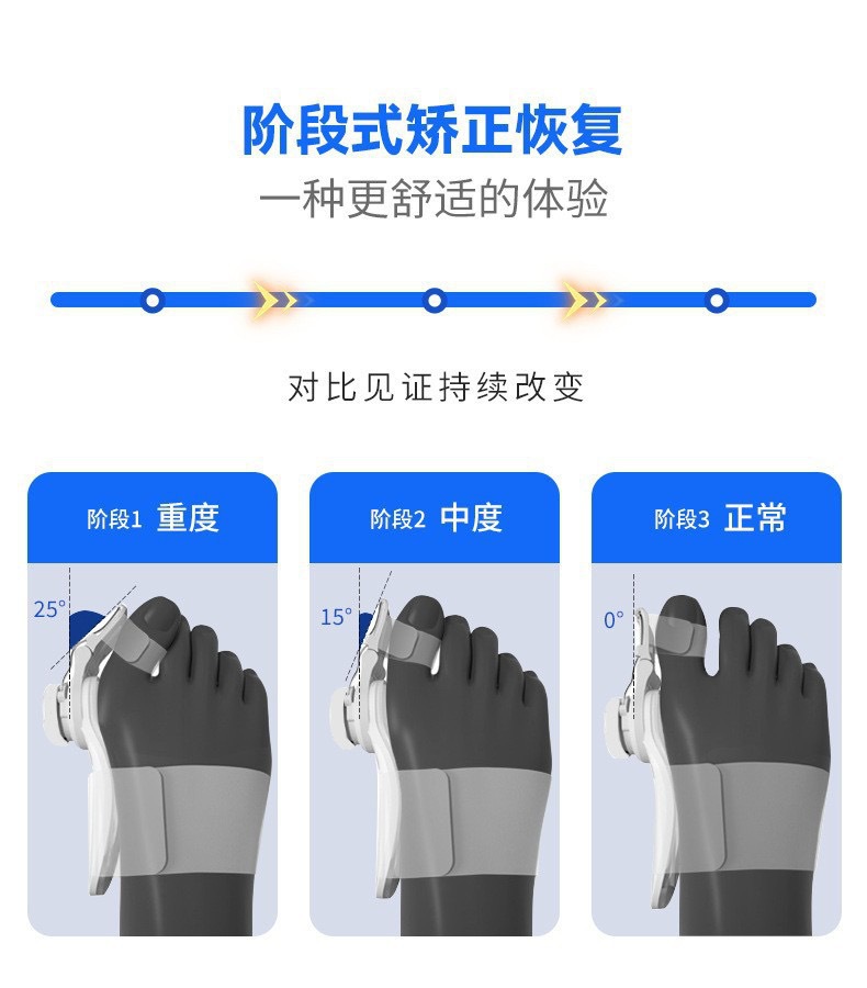 拇外翻脚趾矫正器可调节旋钮拇指分趾器男女均码大脚骨重叠纠正器详情1