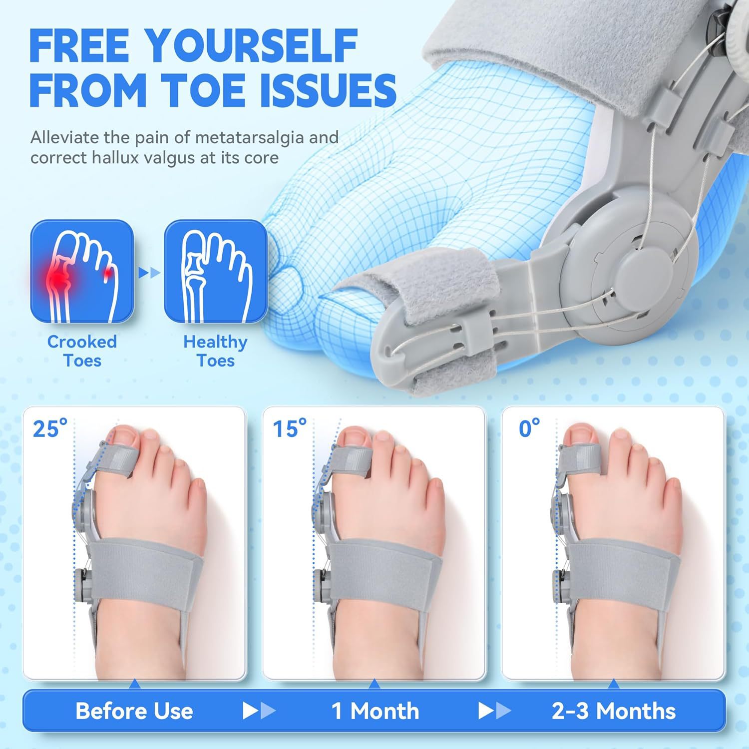 Knob adjustment of the thumb eversion corrector, big foot bone, foot protrusion separator, male and female overlapping toe separator pic 2