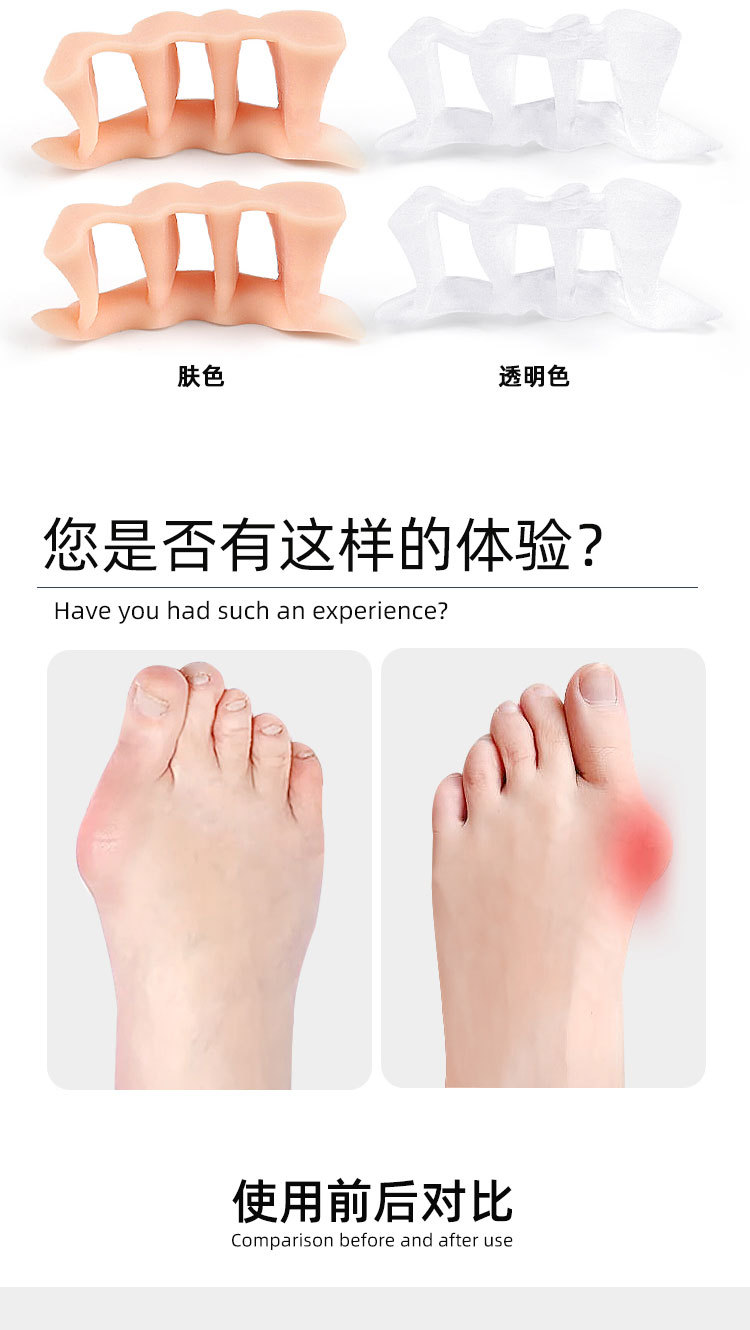 Three-hole hallux valgus toe device, double toe separator, toe separation device, little finger can wear shoe covers pic 37