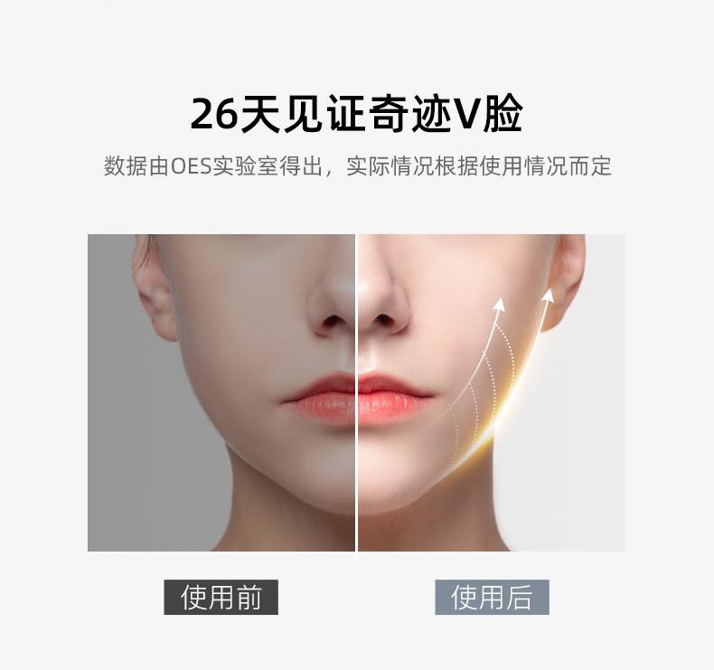 去黑头铲皮机脸面部毛孔清洁铲皮刀家用洁面导入出超声波美容仪器详情18