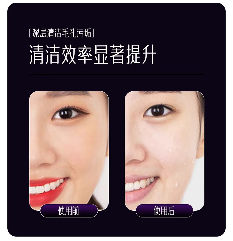 厂家家用美容仪器脸部按摩洁面法令纹提拉紧致面部导入导出仪冰敷详情10