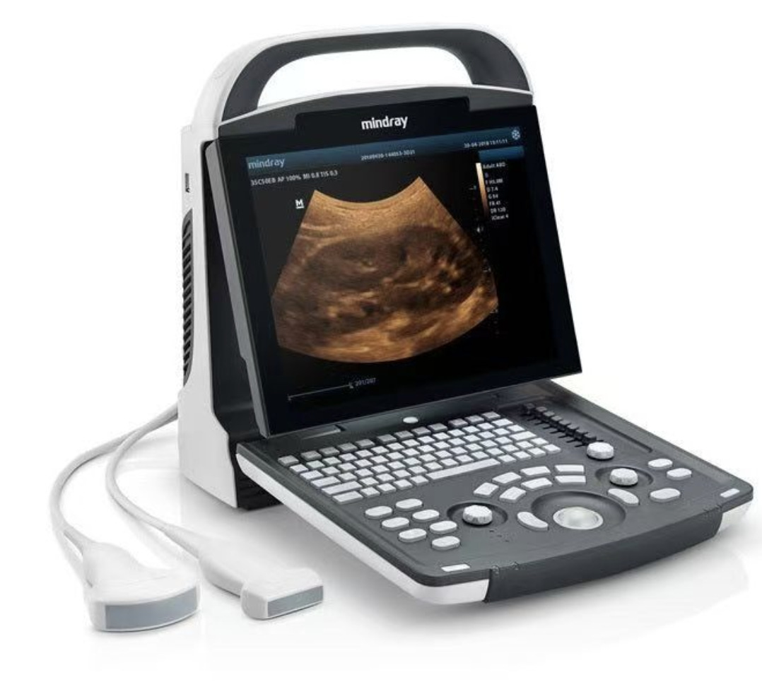 邁瑞醫(yī)用B超機DP-10全數(shù)字便捷式黑白超聲診斷系統(tǒng)搭配腹部探頭詳情15