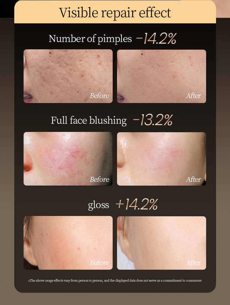 硅胶彩光光子面罩嫩肤仪脸部红蓝光美容面膜仪美容仪家用大排灯详情7