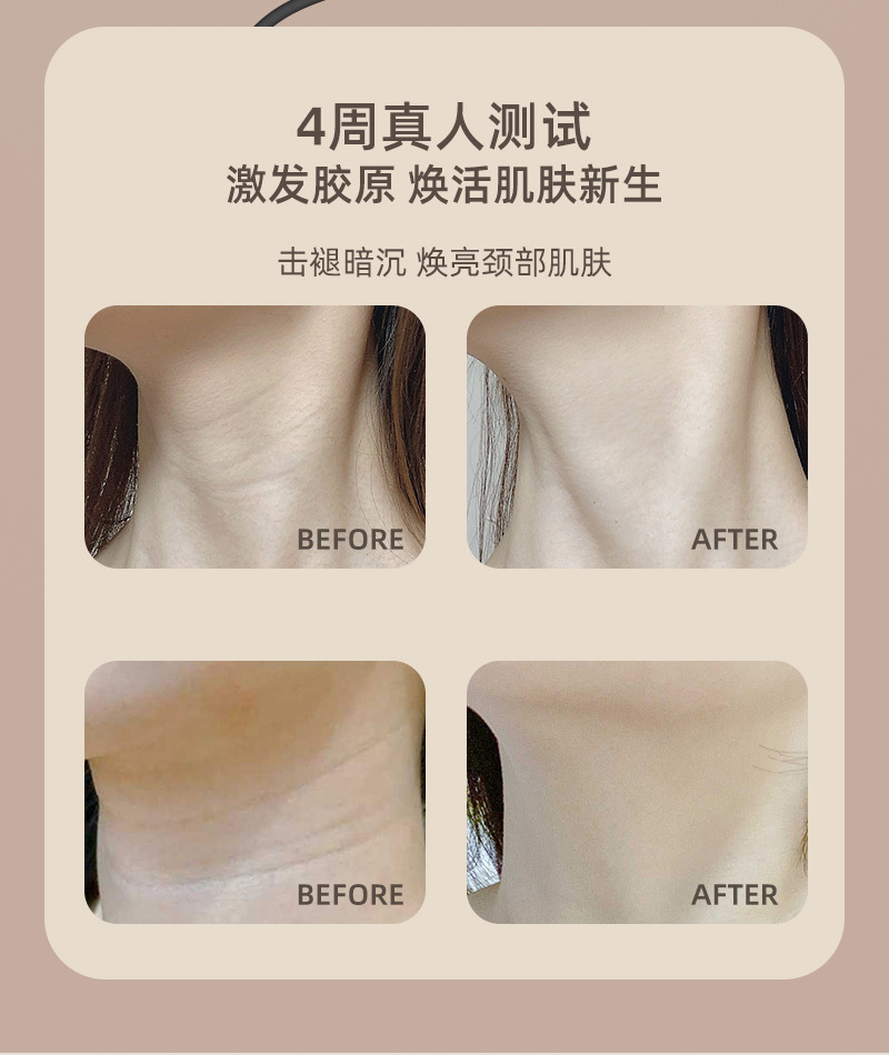 shanilak  680束美容仪器硅胶面罩脖子胸前光子嫩肤仪光谱仪美颈仪 pic 7