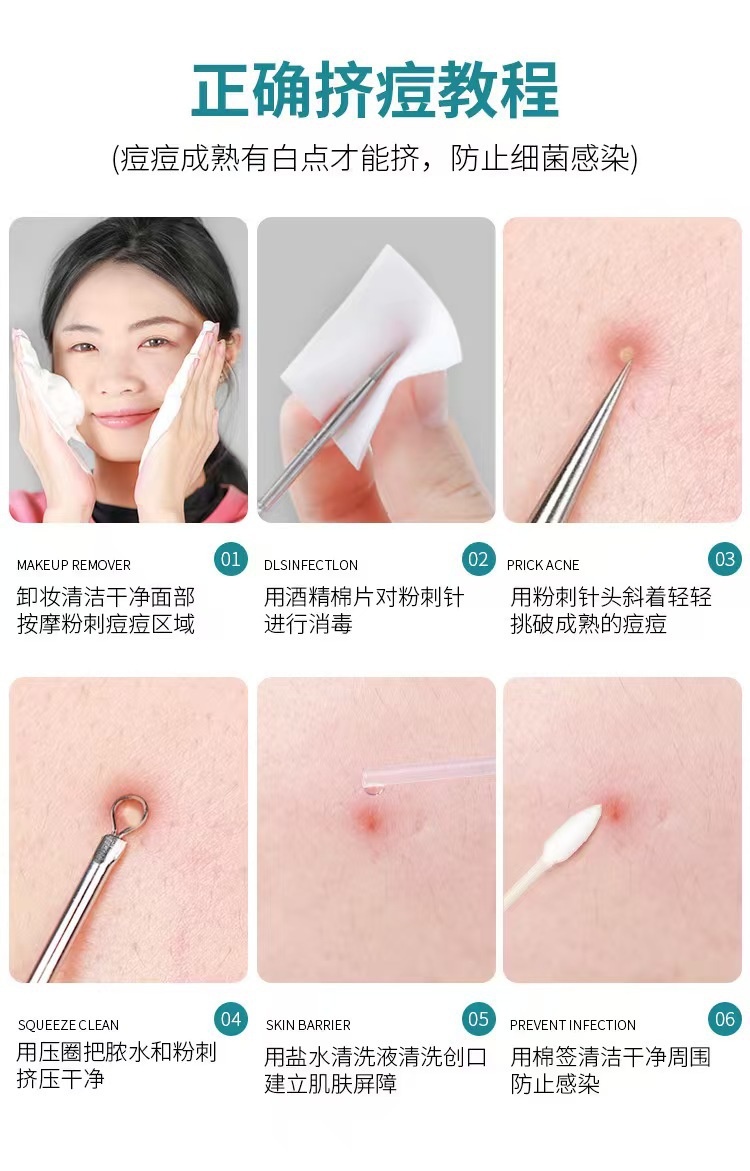 卡盟超尖粉刺针套装超细镊子去黑头刮闭口挑挤痘针美妆工具详情18