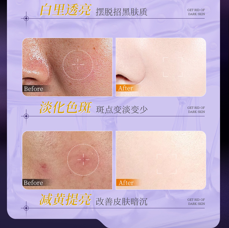 依漾377烟酰胺VC美白次抛精华液去黄祛斑提亮补水保湿熬夜修护详情9