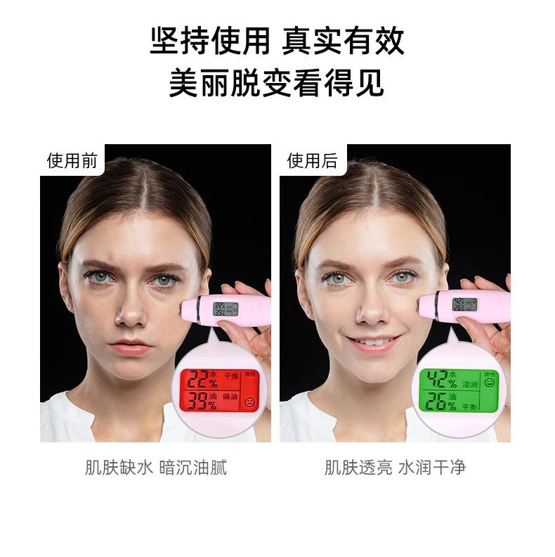 去黑头铲皮机脸面部毛孔清洁铲皮刀家用洁面导入出超声波美容仪器详情16